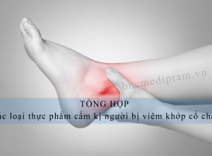 viêm khớp cổ chân kiêng ăn gì